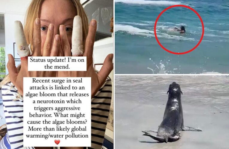 ‘Raised by Wolves’ actress attacked by seal in wild video