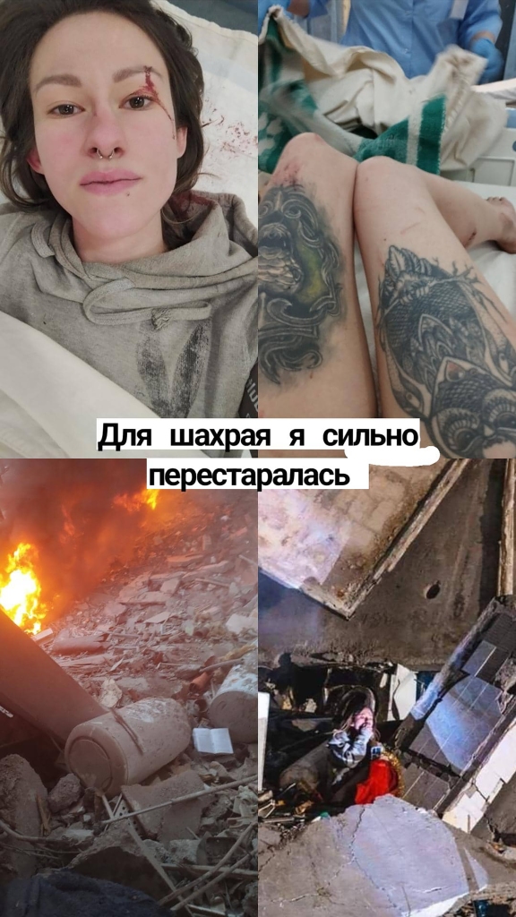 The survivor was reportedly identified as 23-year-old Anastasia Shvets, who shared her story on Instagram, and is pictured here. 