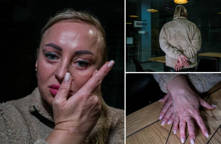 Ukrainian woman reveals harrowing torture by Russians