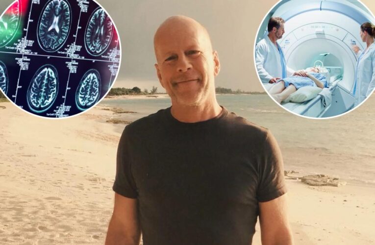 What to know  after  Bruce Willis’ diagnosis