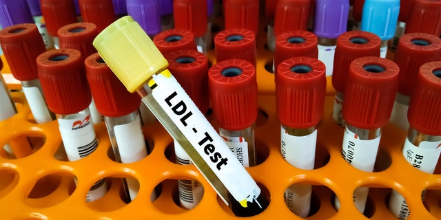 Those who were on a keto-like diet were found to have markedly higher levels of LDL ("bad") cholesterol and apolipoprotein B (apoB), which is a protein that attaches to LDL and can help measure the risk of heart disease.