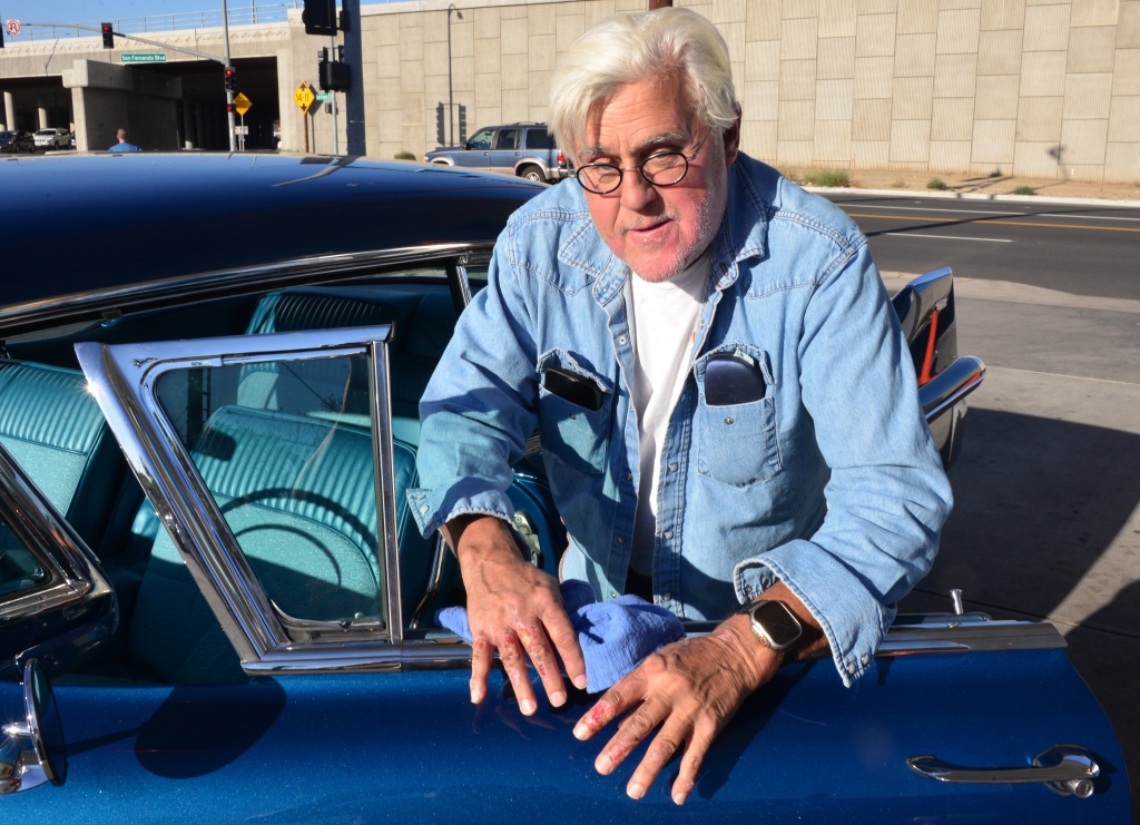 Jay Leno shows off his injuries as fills up a classic car at a gas station in Burbank, Ca around the corner from his famous garage where he suffered 2nd and 3rd degree burns to his face and hands
