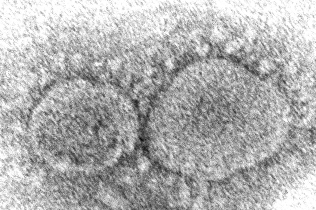 This 2020 electron microscope image made available by the Centers for Disease Control and Prevention shows SARS-CoV-2 virus particles.