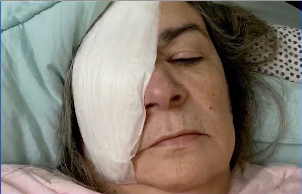 Elderly woman with bandaged eye.