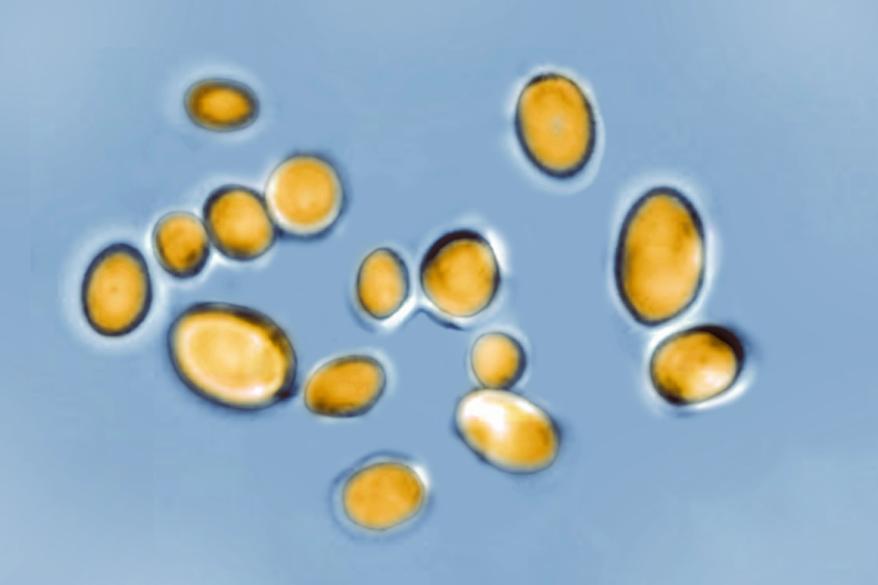 Optical microscope view of Candida auris