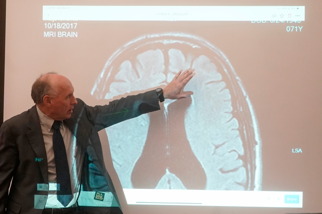 Dr. Wendell Gibby describes an MRI showing the brain of Terry Sanderson.