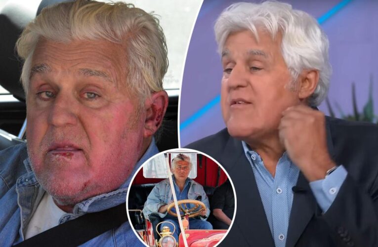 Jay Leno has ‘brand new ear’ after car, motorcycle accidents