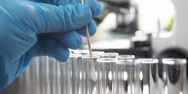 Scientist wearing protective gloves examining dna samples holding cotton stick close-up