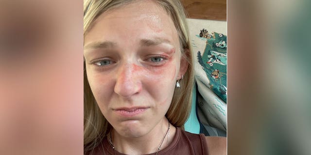 Gabby Petito took this selfie with blood on her face moments prior to an Aug. 12, 2021 traffic stop in Moab, Utah, according to her parents' attorneys. A witness had told police he saw a man hitting a woman outside the Moonflower Co-op, an organic grocer in the heart of the crossroads town.