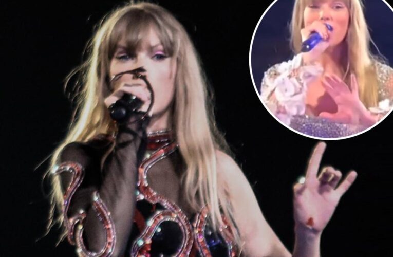 Taylor Swift’s version of her hand injury: ‘Mercury in retrograde coded’