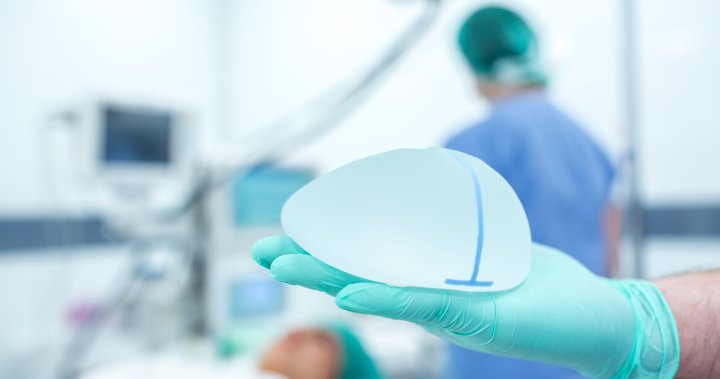 Canada may soon get a breast implant registry. Why experts, patients say it’s crucial