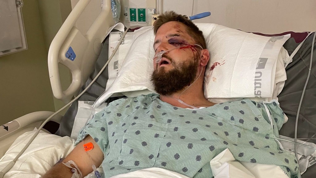 Aric Hutchinson in hospital bed after the crash that killed his new wife, Samantha.