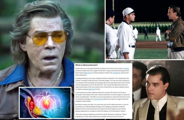 Ray Liotta died of ‘silent killer’ that affects half of US adults over 45