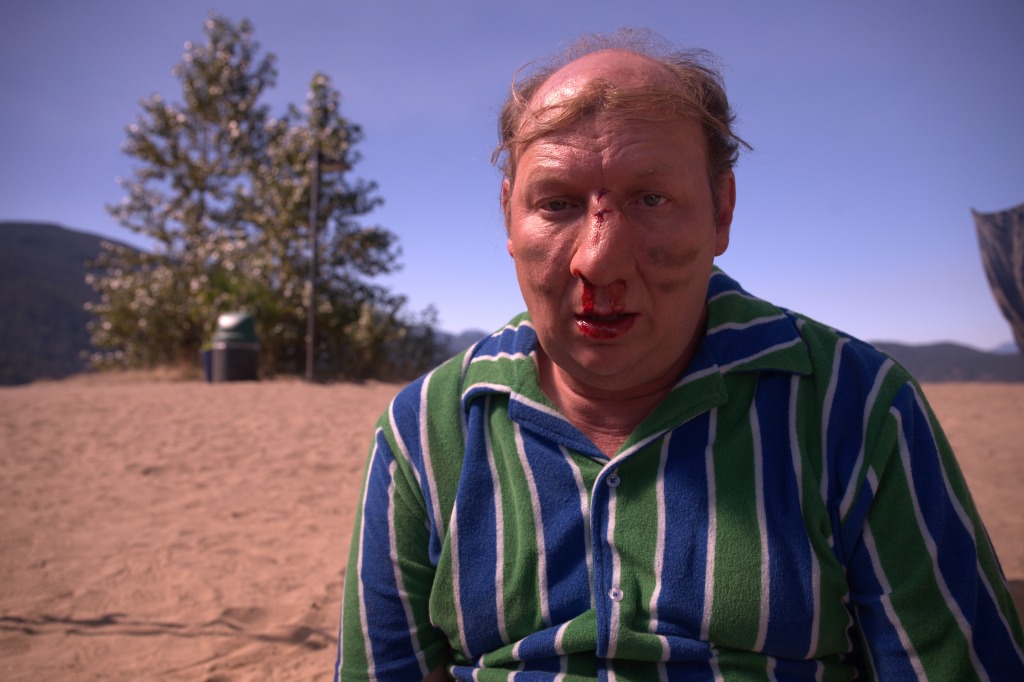 In one of the challenges, Shelly's (Dan Bakkedahl) nose gets violently broken.