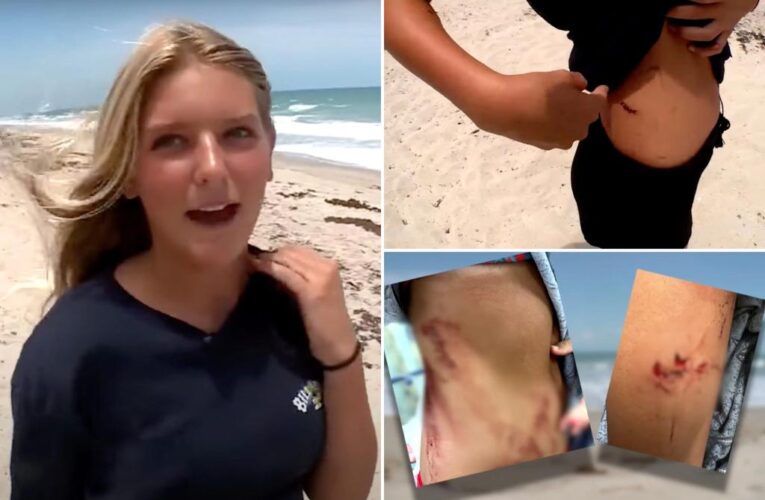 Florida 13-year-old girl Ella Reed fights off shark that attacked her at beach