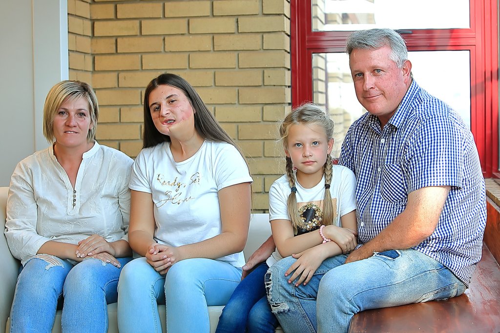 Family wearing blue denim jeans; blonde haired woman, teenager with facial disfiguration, young blonde girl, man in blue plaid shirt. 