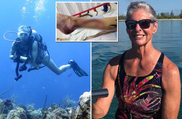 Iowa woman Heidi Ernst loses leg in Bahamas shark attack