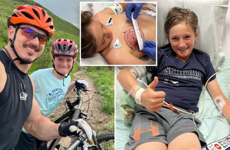 Colorado boy falls off bike, lands on rattlesnake that bites him