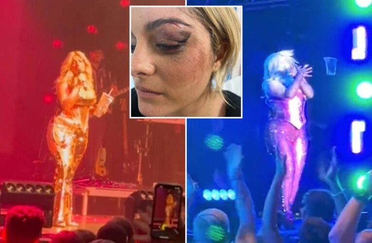 Bebe Rexha tells fans ‘no phones at my face’ in stage return after NYC assault left her with stitches