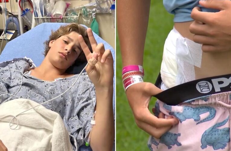 Florida boy, 13, recounts terrifying gator attack: ‘He kept pulling’