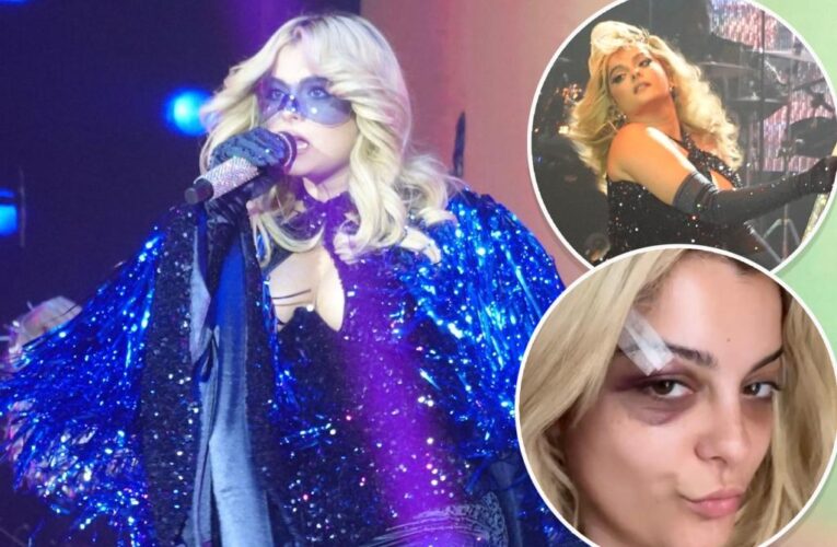 Bebe Rexha wears safety googles on stage after being hit with a phone