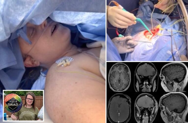 NJ woman sings ‘Sweet Caroline,’ ‘Moana’ in brain surgery