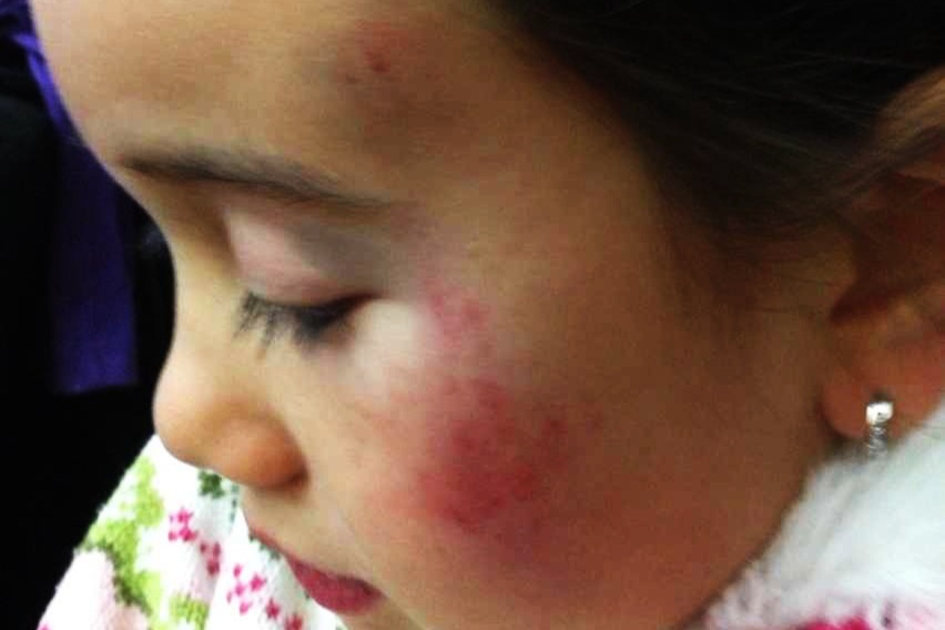 A photo of Lil Tay showing an apparent bruise on her cheek