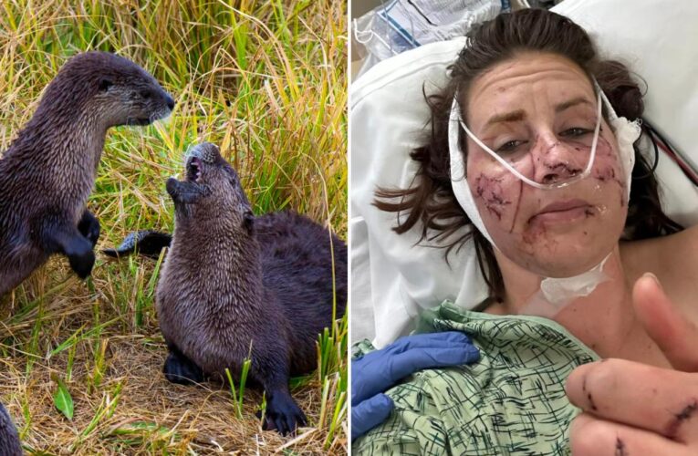 Woman loses half her ear in angry otter attack while tubing down Montana river