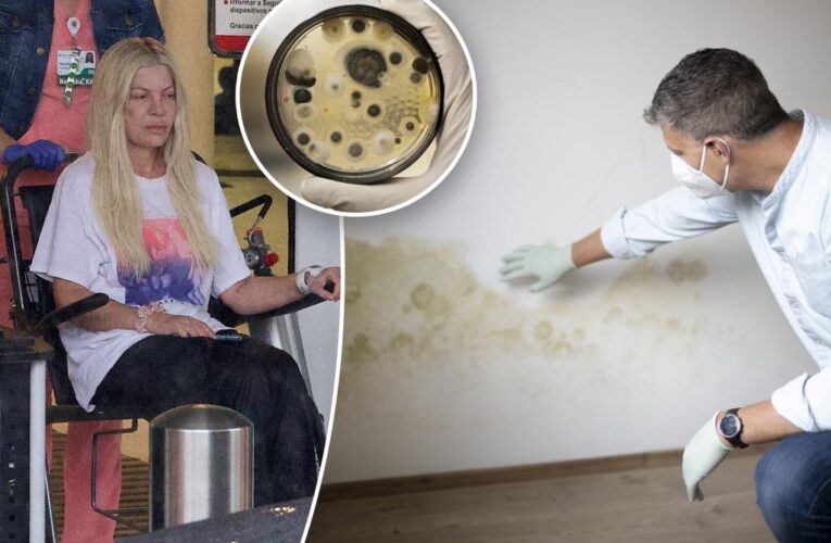 How toxic is mold in our homes? Tori Spelling sparks health concerns