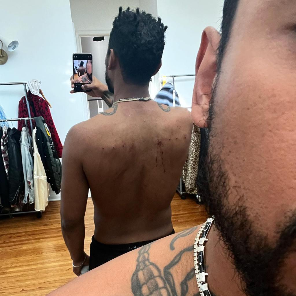 Miguel shares bloody T-shirt photo after performing while suspended from ropes pierced through his skin