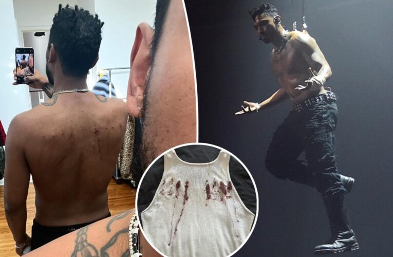 Miguel ‘Viscera’ album event goes viral for gory skin piercing stunt