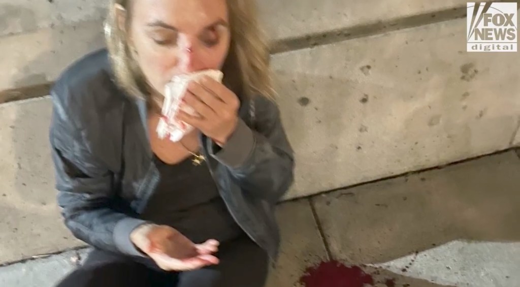 One photo from the sidewalk shows the dazed doctor holding up a couple of napkins to her face as she sits next to a pool of her blood.