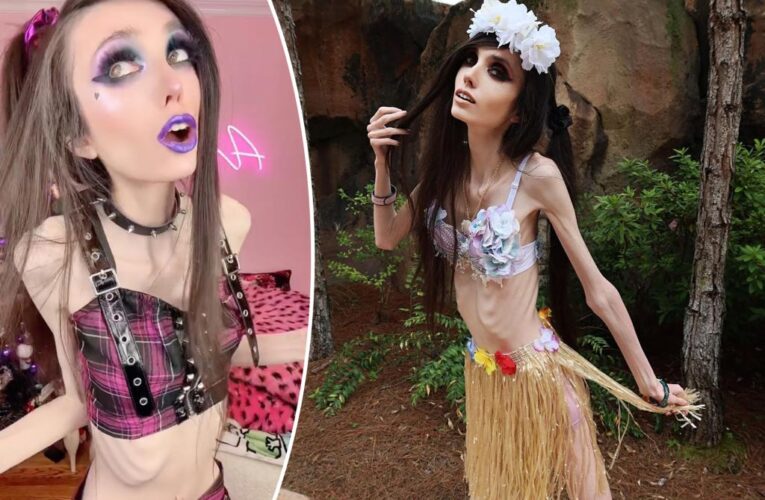 Eugenia Cooney’s ‘thin’ figure sparks worry amid eating disorder: