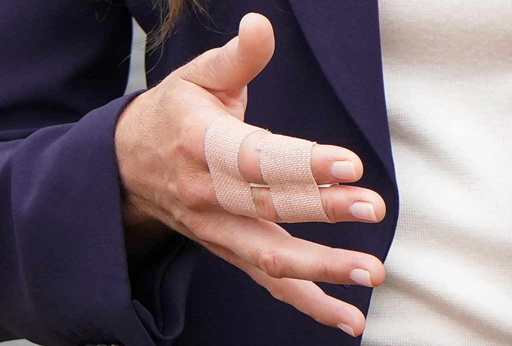 Kate Middelton's fingers wrapped in bandaids. 