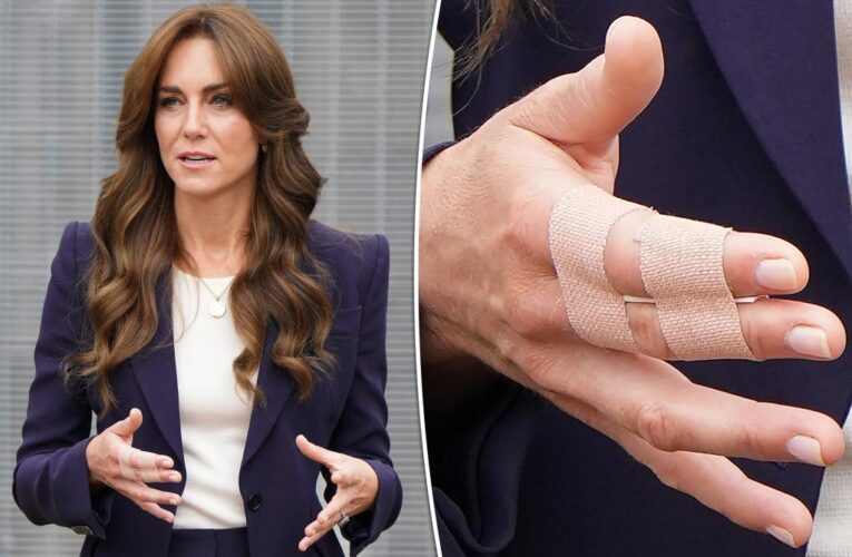 Kate Middleton visits prison with a mysterious hand injury