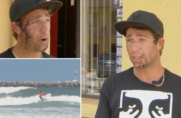 Surfer shows scars from shark biting his face in Florida