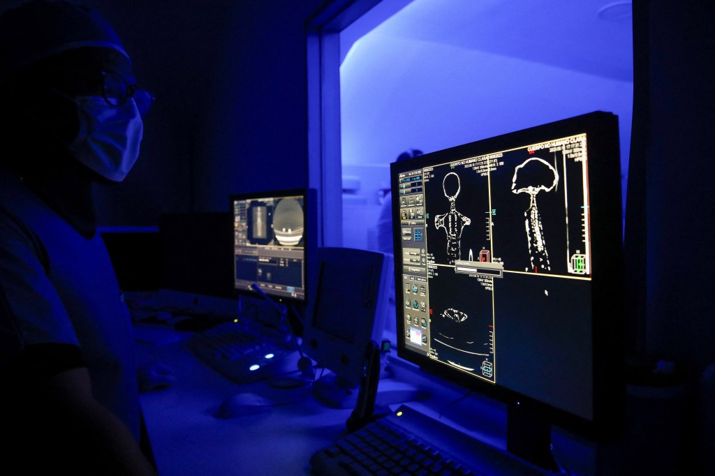 Radiologist technician Guillermo Ramirez examines a CT scan of a tiny body of a specimen