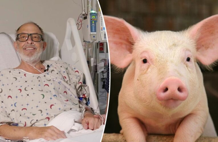 Second-ever pig heart transplant saves dying man: ‘Now I have hope’
