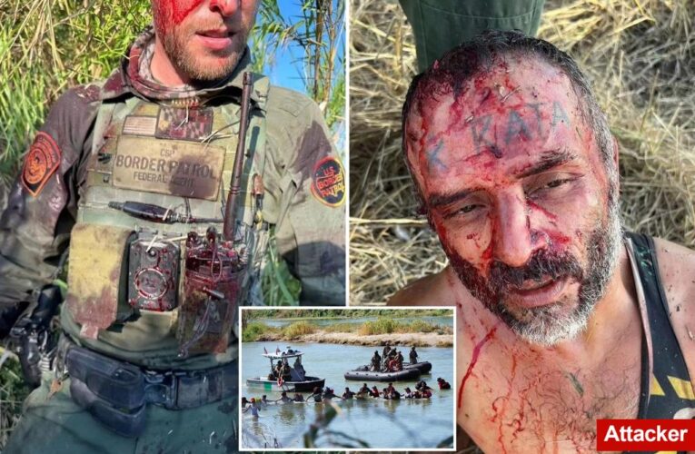 Mayra Flores shares pic of bloodied Border Patrol agent