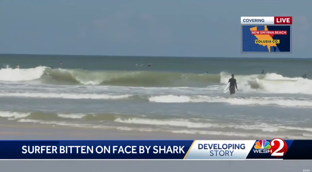 The surfer, who was transported to the Halifax Health trauma center, claimed the shark attacked him off his board after riding a wave.