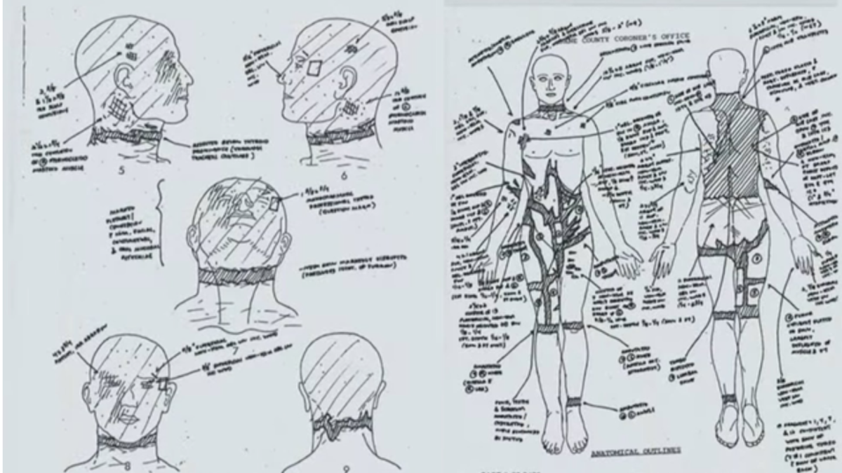 Shad Thyrion Autopsy diagram