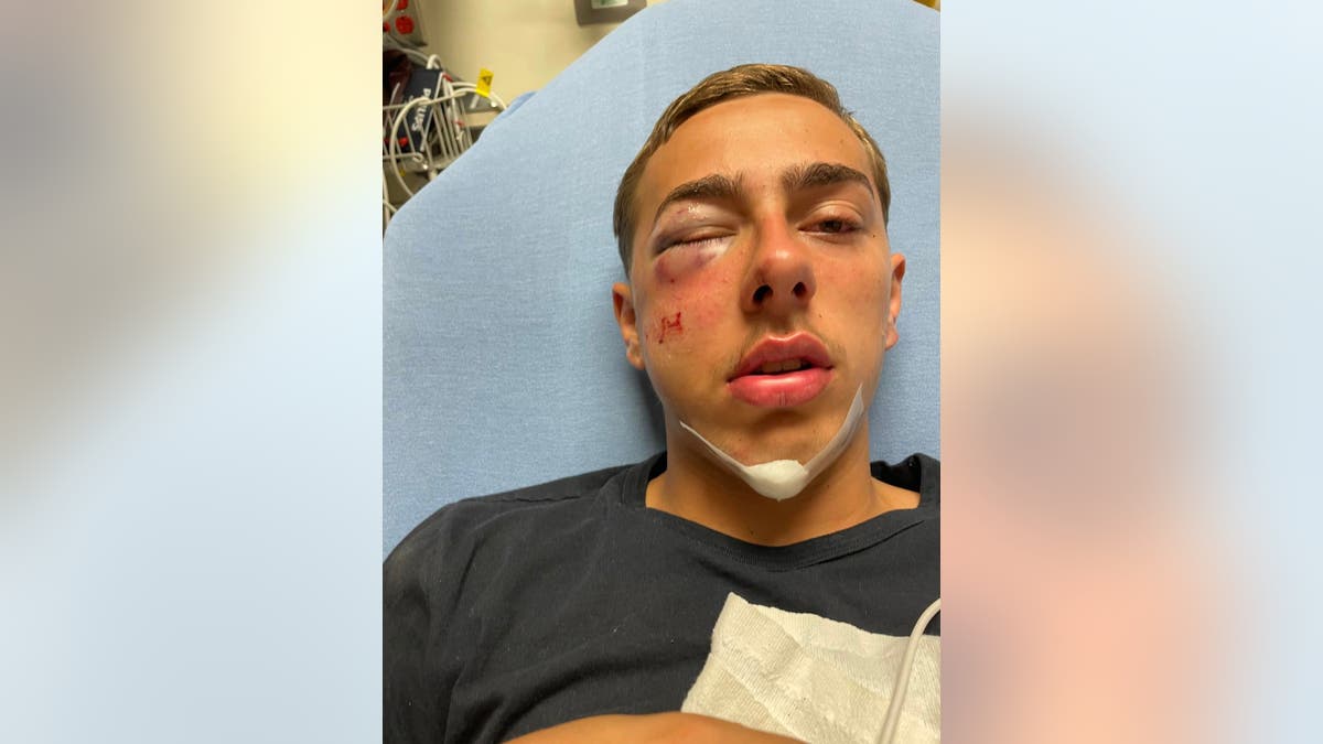 Injuries suffered by 15-year-old during state trooper's alleged assault