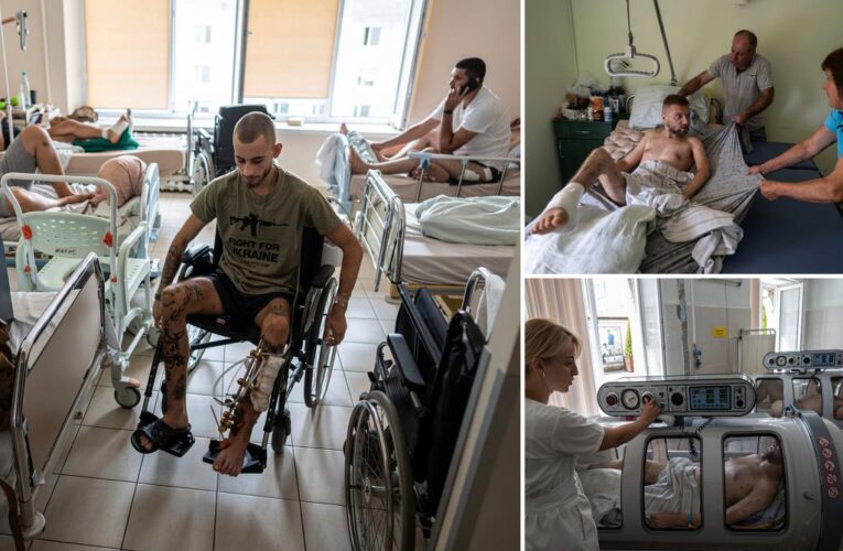 Upward of 20,000 Ukrainian amputees face trauma on a scale unseen since WWI