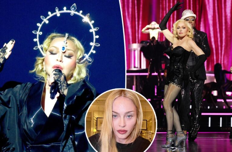 Madonna says she was in an ‘induced coma for 48 hours’ after bacterial infection