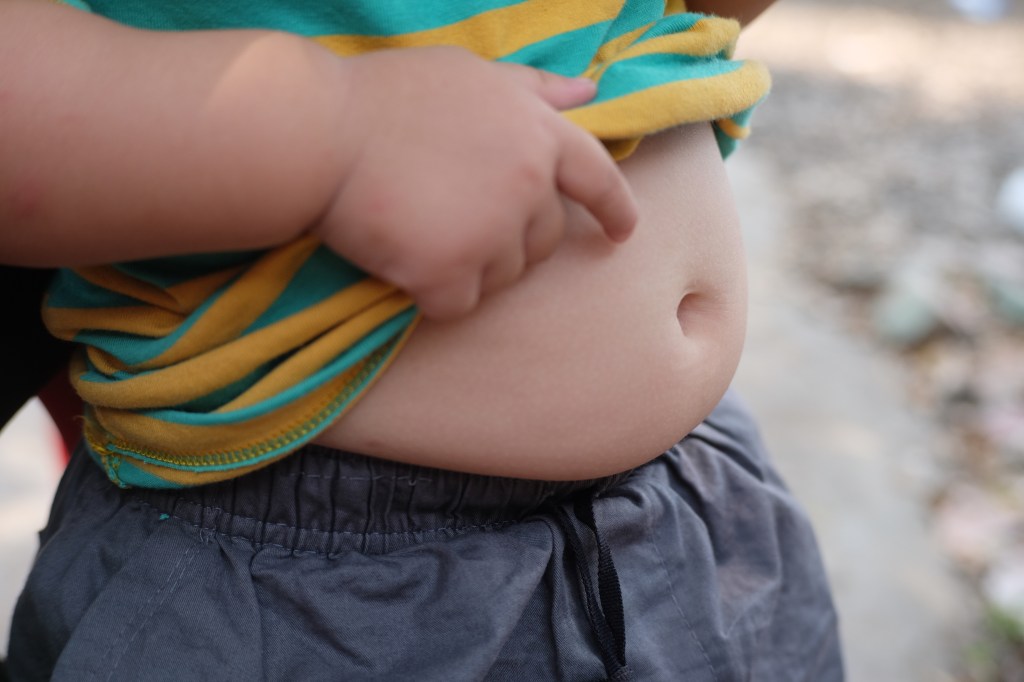 The increase echoes other national data, which suggests around 2.5% of all preschool-aged children were severely obese during the same period.