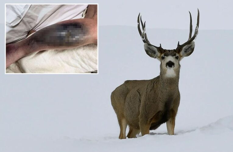 Colorado woman, 67, suffers horrific puncture wound after mule deer gores her outside her home
