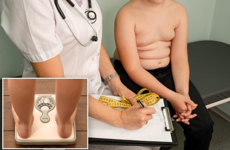 Study bolsters evidence that severe obesity increasing in young US kids