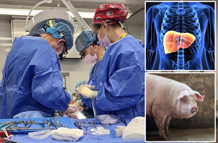 A first-ever experiment shows how pigs might one day help people who have liver failure