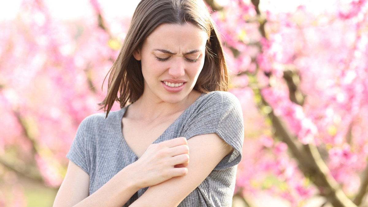 Mosquito bite woman