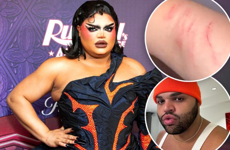 ‘RuPaul’s Drag Race’ alum Kandy Muse assaulted at club